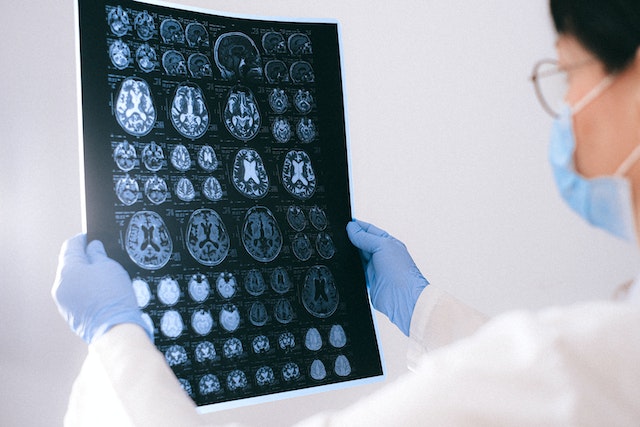 doctor in mask and gloves looking at scans on human brain